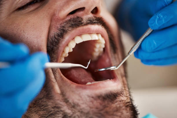 Best Urgent Care for Lost Fillings or Crowns in West Hill, OH